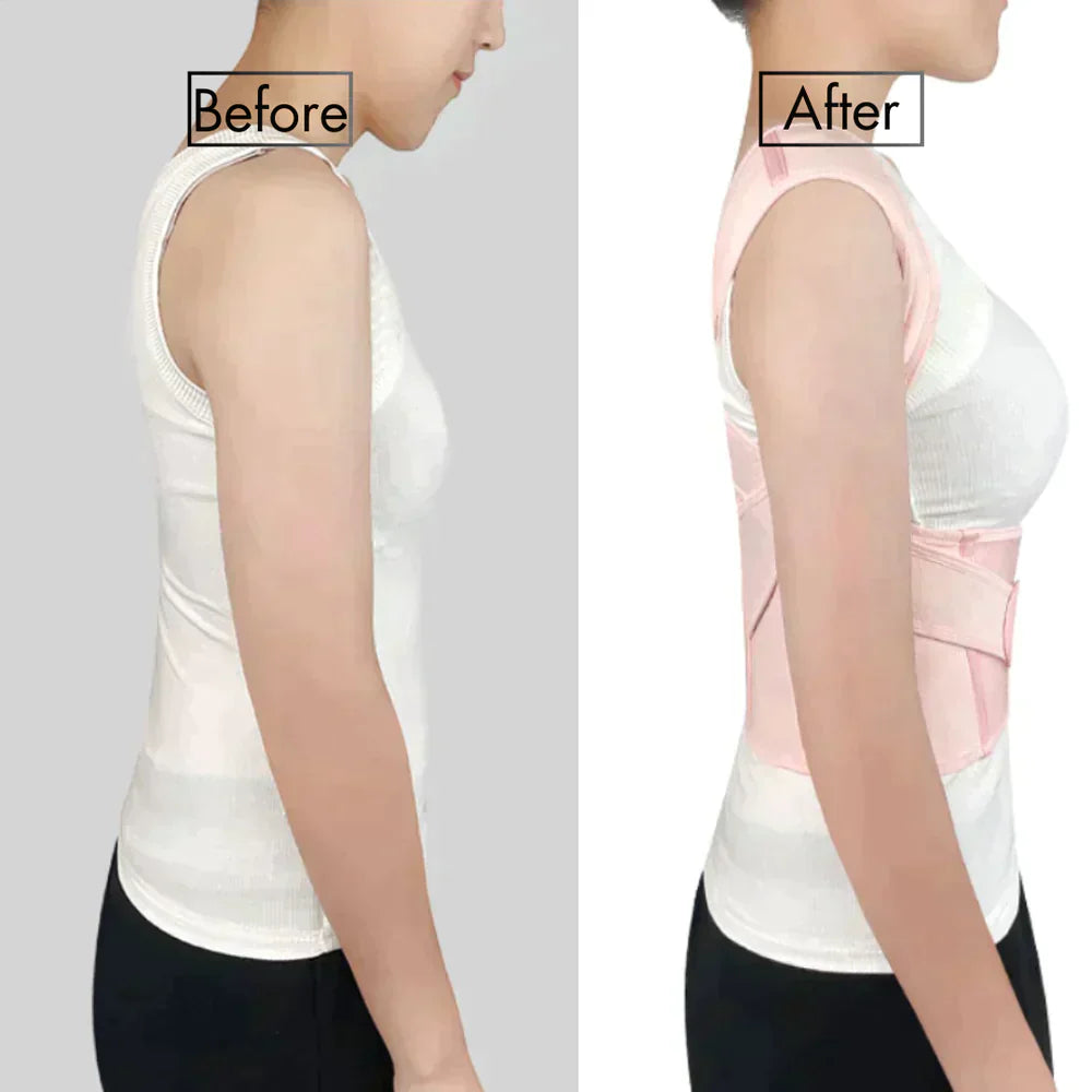 Posture Corrector