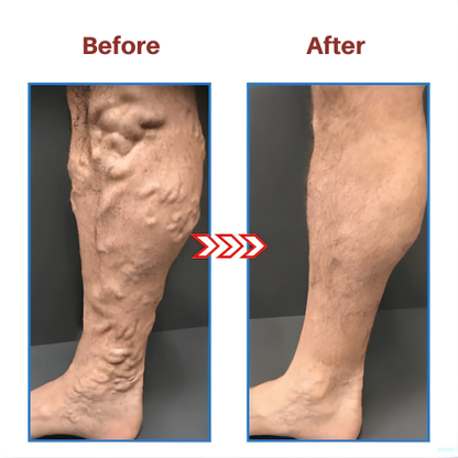 SootheFlex™  – Soothe Your Feet, Rejuvenate Your Body