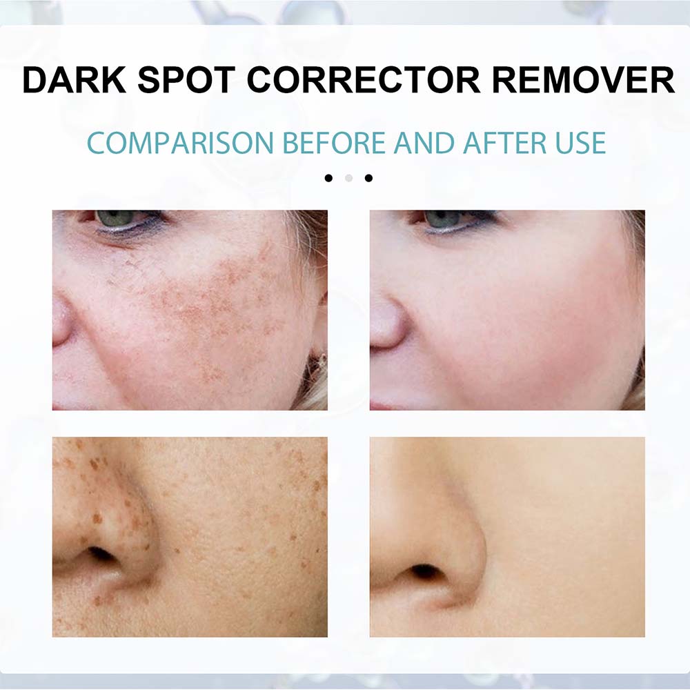 Dark Spot Fading Cream with Nicotinamide and Hydrating Blend for All Skin Types