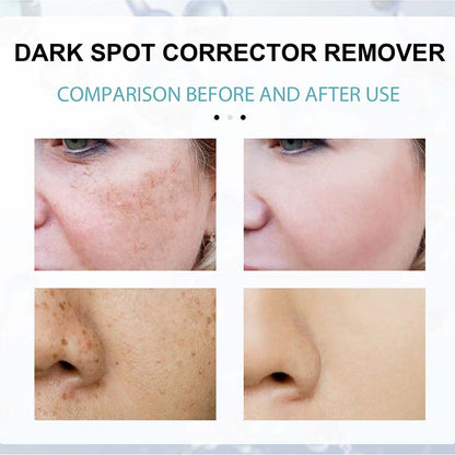 Dark Spot Fading Cream with Nicotinamide and Hydrating Blend for All Skin Types
