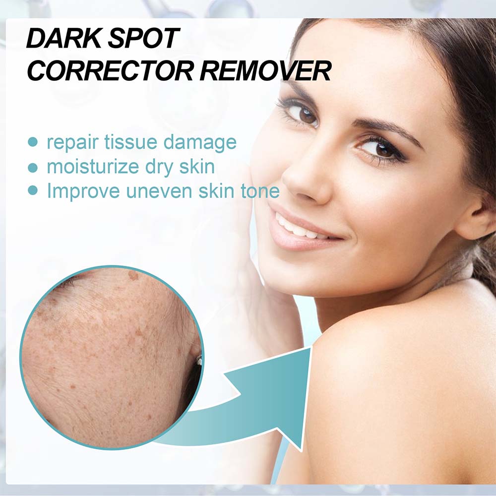 Dark Spot Fading Cream with Nicotinamide and Hydrating Blend for All Skin Types