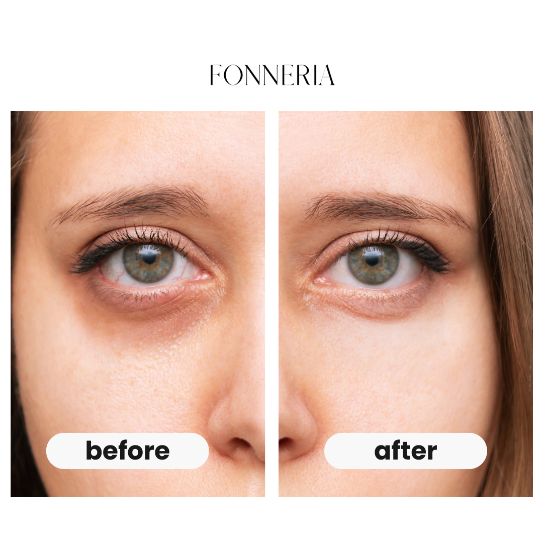 Fonneria unwind – eye beauty pro