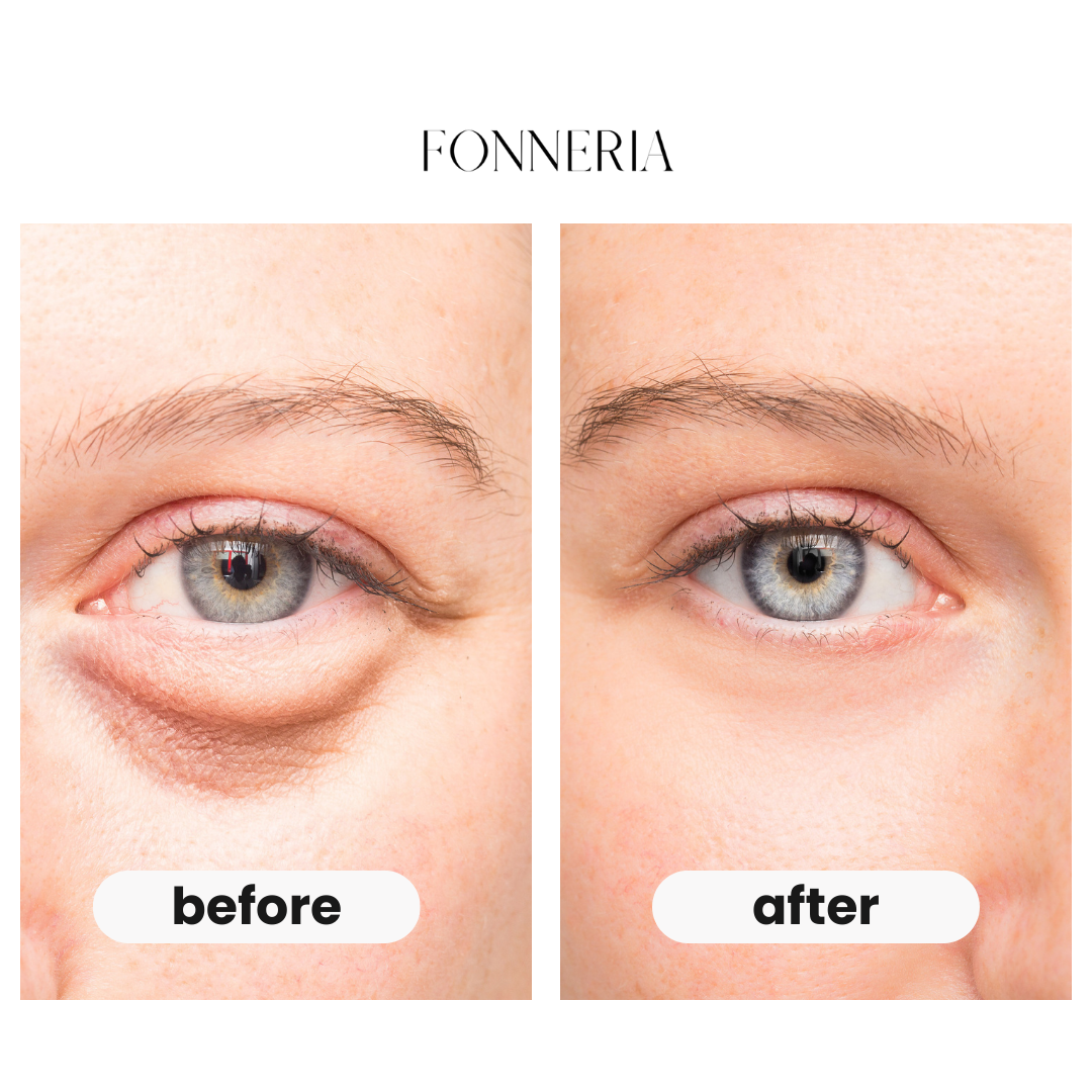 Fonneria unwind – eye beauty pro